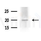JTB Antibody - Western blot analysis of extracts from B16F10-LUC cells(heat-shock,45min treatment), using JTB Antibody at 1/1000 dilution.