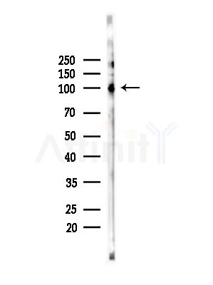 KIF20A Antibody - Western blot analysis of lysates from COLO205 cells(heat-shock,45min treatment), using KIF20A Antibody at 1/1000 dilution.