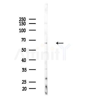 KLHL3 Antibody - Western blot analysis of lysates from Hela cells(heat-shock,45min treatment), using KLHL3 Antibody at 1/1000 dilution.