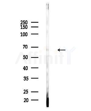 KLHL3 Antibody - Western blot analysis of lysates from Mouse testis, using KLHL3 Antibody at 1/1000 dilution.