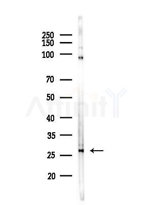 OR10X1 Antibody - Western blot analysis of lysates from PC12 cells(LPS, 4h treatment), using OR10X1 Antibody at 1/1000 dilution.