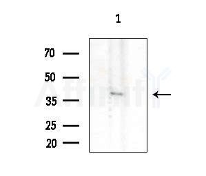OR7C2 Antibody - Western blot analysis of extracts from EC304 cells, using OR7C2 Antibody at 1/1000 dilution.