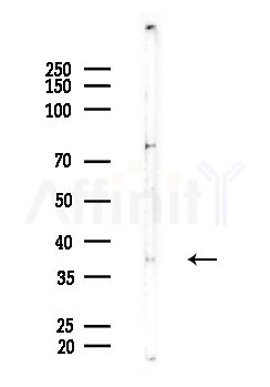 OR7C2 Antibody - Western blot analysis of lysates from EC304 cells, using OR7C2 Antibody at 1/1000 dilution.