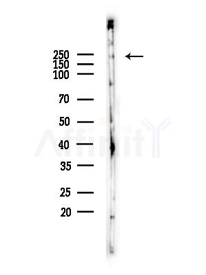 PIP5K Antibody - Western blot analysis of lysates from Rat brain, using PIP5K Antibody at 1/1000 dilution.