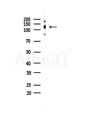 POM121 Antibody - Western blot analysis of lysates from COLO205 cells(heat-shock,45min treatment), using POM121 Antibody at 1/1000 dilution.