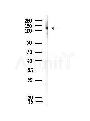 POM121 Antibody - Western blot analysis of lysates from Rat brain, using POM121 Antibody at 1/1000 dilution.