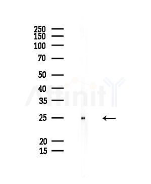 Prostate Stem Cell Antigen Antibody - Western blot analysis of lysates from Rat liver, using Prostate Stem Cell Antigen Antibody at 1/1000 dilution.