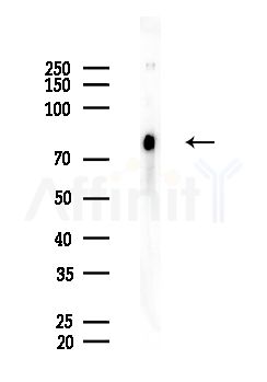 RGPD2/3/4/6/8 Antibody - Western blot analysis of lysates from EC304 cells, using RGPD2/3/4/6/8 Antibody at 1/1000 dilution.