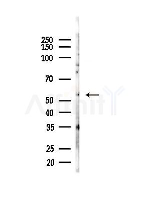 RMP Antibody - Western blot analysis of lysates from COLO205 cells(heat-shock,45min treatment), using RMP Antibody at 1/1000 dilution.