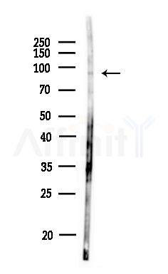 RNF19A Antibody - Western blot analysis of lysates from MDA-MB-231 cells(heat-shock,45min treatment), using RNF19A Antibody at 1/1000 dilution.