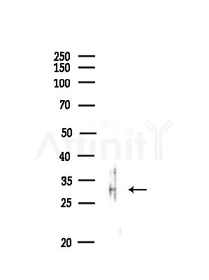 TAS2R43 Antibody - Western blot analysis of lysates from Rat lung, using TAS2R43 Antibody at 1/1000 dilution.
