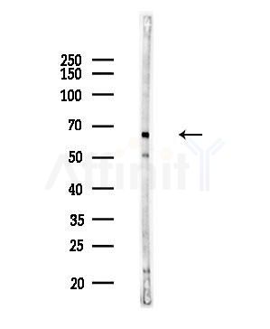TBX15/18 Antibody - Western blot analysis of lysates from COLO205 cells(heat-shock,45min treatment), using TBX15/18 Antibody at 1/1000 dilution.