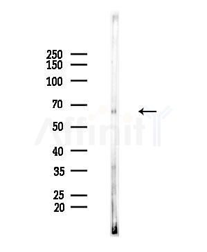 TBX15/18 Antibody - Western blot analysis of lysates from Hela cells(heat-shock,45min treatment), using TBX15/18 Antibody at 1/1000 dilution.