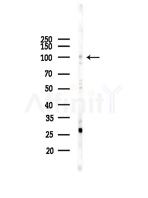 TF3C3 Antibody - Western blot analysis of lysates from COLO205 cells(UV,30min treatment), using TF3C3 Antibody at 1/1000 dilution.