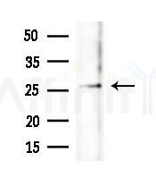 UBTD2 Antibody - Western blot analysis of extracts from B16F10-LUC cells(heat-shock,45min treatment), using UBTD2 Antibody at 1/1000 dilution.