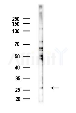 UBTD2 Antibody - Western blot analysis of lysates from B16F10-LUC cells(heat-shock,45min treatment), using UBTD2 Antibody at 1/1000 dilution.