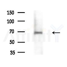 ZNF23 Antibody - Western blot analysis of extracts from various samples, using ZNF23 Antibody at 1/1000 dilution.