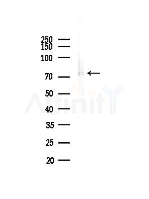ZNF23 Antibody - Western blot analysis of lysates from HepG2 cells(starvation,24h treatment), using ZNF23 Antibody at 1/1000 dilution.