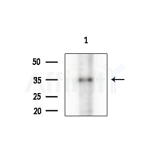 Phospho-Casein Kinase 1 alpha (Tyr294) Antibody - Western blot analysis of extracts from COLO205 cells(heat-shock treatment), using Phospho-Casein Kinase 1 alpha (Tyr294) Antibody at 1/1000 dilution.