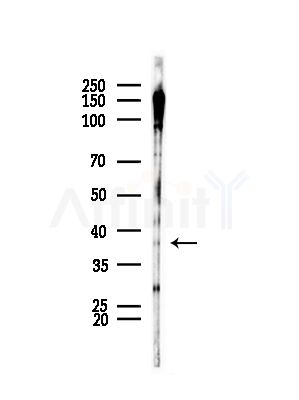 Phospho-Casein Kinase 1 alpha (Tyr294) Antibody - Western blot analysis of lysates from COLO205 cells(heat-shock,45min treatment), using Phospho-Casein Kinase 1 alpha (Tyr294) Antibody at 1/1000 dilution.