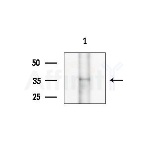 Phospho-Ephrin B1/B2/B3 (Tyr324) Antibody - Western blot analysis of extracts from COLO205 cells(heat-shock treatment), using Phospho-Ephrin B1/B2/B3 (Tyr324) Antibody at 1/1000 dilution.