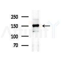 Phospho-MEKK1 (Thr1402)[Thr1400] Antibody - Western blot analysis of lysates from HepG2 cells(heat-shock,45min treatment), using Phospho-MEKK1 (Thr1402)[Thr1400] Antibody at 1/1000 dilution.