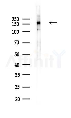 Phospho-MEKK1 (Thr1402)[Thr1400] Antibody - Western blot analysis of lysates from HepG2 cells(heat-shock,45min treatment), using Phospho-MEKK1 (Thr1402)[Thr1400] Antibody at 1/1000 dilution.