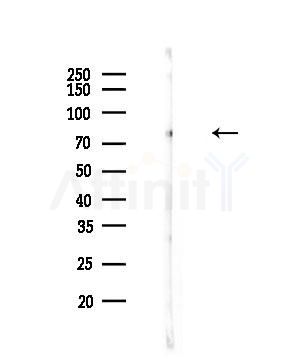Phospho-RSK1/2/3/4 (Ser221/Ser227/Ser218/Ser232) Antibody - Western blot analysis of lysates from A549 cells(heat-shock,45min treatment), using Phospho-RSK1/2/3/4 (Ser221/Ser227/Ser218/Ser232) Antibody at 1/1000 dilution.