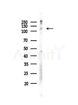 ASAP1 antibody Antibody - Western blot analysis of lysates from EC304 cells(heat-shock,45min treatment), using ASAP1 antibody Antibody at 1/1000 dilution.