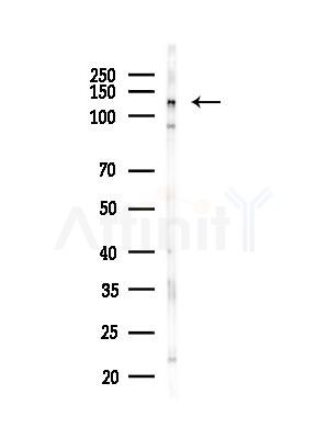 ASAP1 antibody Antibody - Western blot analysis of lysates from PC12 cells(LPS, 4h treatment), using ASAP1 antibody Antibody at 1/1000 dilution.