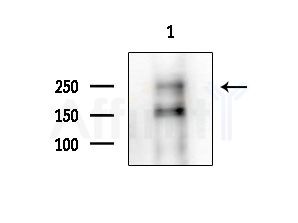 CHD1 Antibody - Western blot analysis of extracts from COLO205 cells(heat-shock treatment), using CHD1 Antibody at 1/1000 dilution.