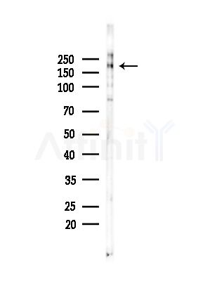 CHD1 Antibody - Western blot analysis of lysates from COLO205 cells(heat-shock,45min treatment), using CHD1 Antibody at 1/1000 dilution.