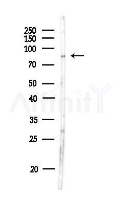 NKRF Antibody - Western blot analysis of lysates from MDA-MB-231 cells(heat-shock,45min treatment), using NKRF Antibody at 1/1000 dilution.