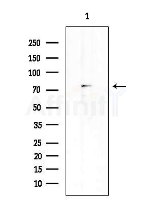 DYRK3 Antibody - Western blot analysis of extracts from EC304 cells, using DYRK3 Antibody at 1/1000 dilution.