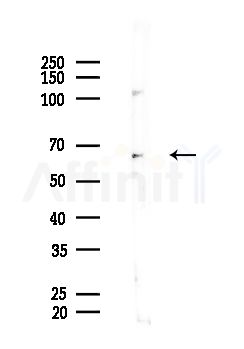 DYRK3 Antibody - Western blot analysis of lysates from EC304 cells, using DYRK3 Antibody at 1/1000 dilution.