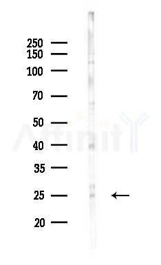 SAP30 Antibody - Western blot analysis of lysates from HepG2 cells(heat-shock,45min treatment), using SAP30 Antibody at 1/1000 dilution.