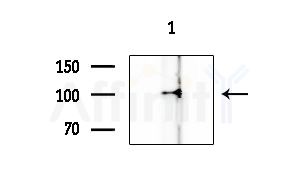 CDKL5 Antibody - Western blot analysis of extracts from HUVEC cells, using CDKL5 Antibody at 1/1000 dilution.