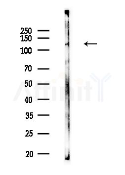 CDKL5 Antibody - Western blot analysis of lysates from HUVEC cells, using CDKL5 Antibody at 1/1000 dilution.