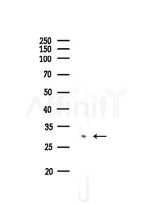 FSBP Antibody - Western blot analysis of lysates from COLO205 cells(heat-shock,45min treatment), using FSBP Antibody at 1/1000 dilution.