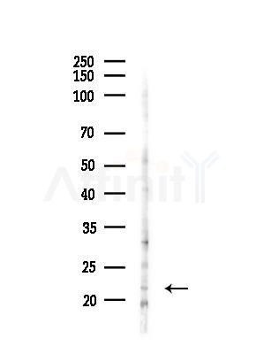 DUSP14 Antibody - Western blot analysis of lysates from Hela cells(heat-shock,45min treatment), using DUSP14 Antibody at 1/1000 dilution.