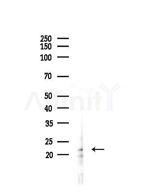 DUSP14 Antibody - Western blot analysis of lysates from COLO205 cells(UV,30min treatment), using DUSP14 Antibody at 1/1000 dilution.