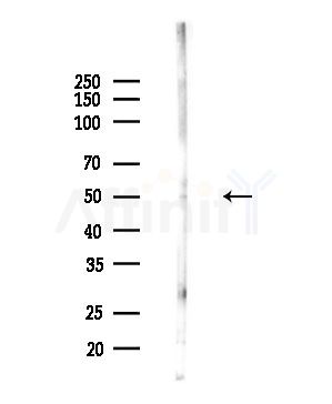 ZIC1/2/3/4/5 Antibody - Western blot analysis of lysates from PC12 cells(LPS,4h treatment), using ZIC1/2/3/4/5 Antibody at 1/1000 dilution.