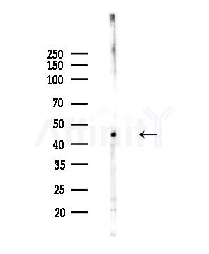 ZIC1/2/3/4/5 Antibody - Western blot analysis of lysates from Hela cells(starvation,24h treatment), using ZIC1/2/3/4/5 Antibody at 1/1000 dilution.