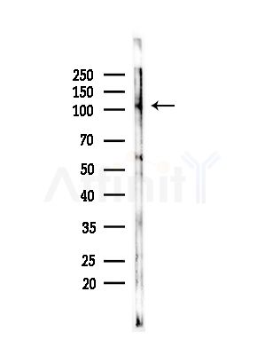 RECK Antibody - Western blot analysis of lysates from COLO205 cells(heat-shock,45min treatment), using RECK Antibody at 1/1000 dilution.