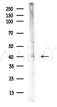 KITH_HHV1S Antibody - Western blot analysis of lysates from A375 cells(heat-shock,45min treatment), using KITH_HHV1S Antibody at 1/1000 dilution.