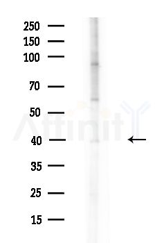 KITH_HHV1S Antibody - Western blot analysis of lysates from HUVEC cells(UV,30min treatment), using KITH_HHV1S Antibody at 1/1000 dilution.