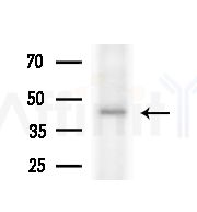 KR1_VZVD Antibody - Western blot analysis of extracts from HepG2 cells(heat-shock,45min treatment), using KR1_VZVD Antibody at 1/1000 dilution.