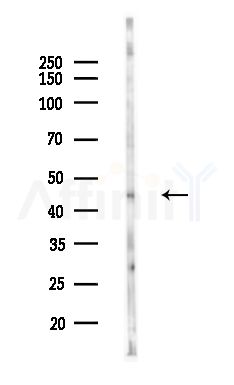 KR1_VZVD Antibody - Western blot analysis of lysates from HepG2 cells(heat-shock,45min treatment), using KR1_VZVD Antibody at 1/1000 dilution.