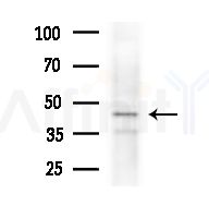 KR2_VZVD Antibody - Western blot analysis of extracts from HepG2 cells(heat-shock,45min treatment), using KR2_VZVD Antibody at 1/1000 dilution.