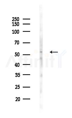 KR2_VZVD Antibody - Western blot analysis of lysates from HepG2 cells(heat-shock,45min treatment), using KR2_VZVD Antibody at 1/1000 dilution.
